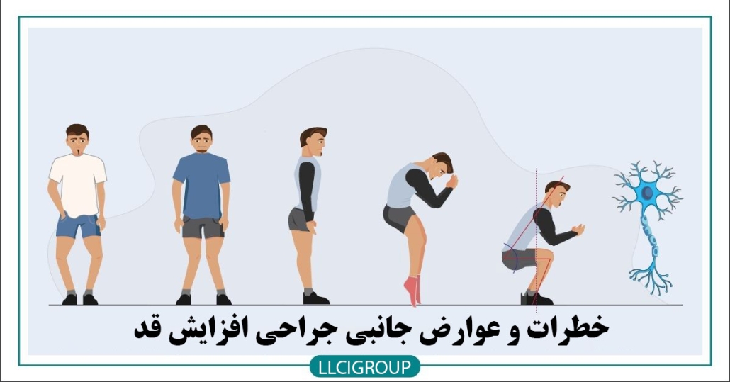 خطرات و عوارض جانبی جراحی افزایش قد