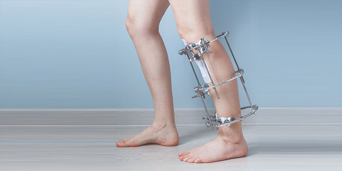 عوارض عمل جراحی الیزاروف